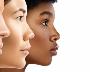 Skin Type